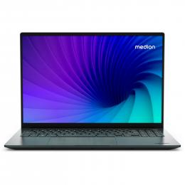 MEDION S10 Laptop, Intel® Core™ Ultra 7 155H, Windows 11 Home, 40,6 cm (16,0'') QHD+ OLED Display, 1 TB SSD, 16 GB RAM